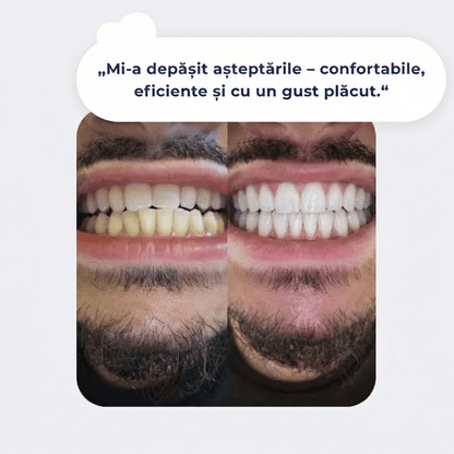 Benzi de albire PAP+